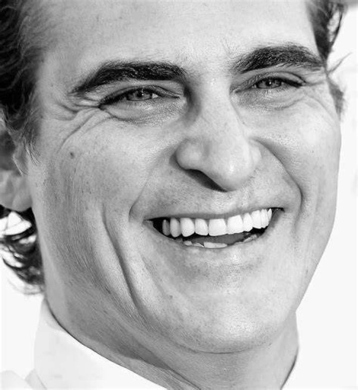 25 Celebrities Born With Cleft Lips ViraLuck