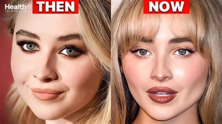 Did Sabrina Carpenter Have Plastic Surgery? Everything You Need To Know