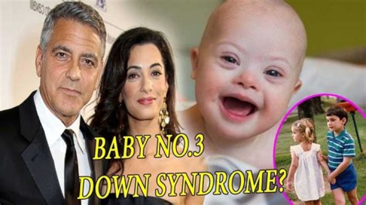 Does George Clooney Have A Child With Down Syndrome: The Uncovered Truth