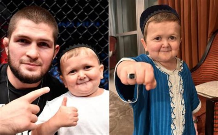 Essential Guide To Hasbulla: The Internet's Beloved Enigma