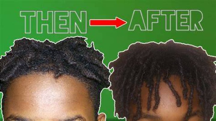 How To Make Dreads Grow Faster And Longer