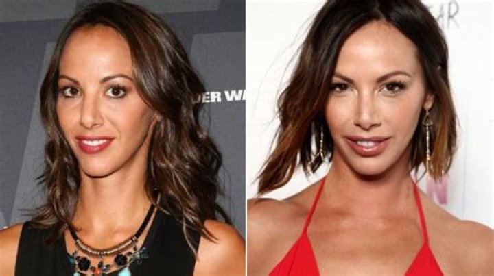 Kristen Doute's Surgery: A Change In Her Appearance