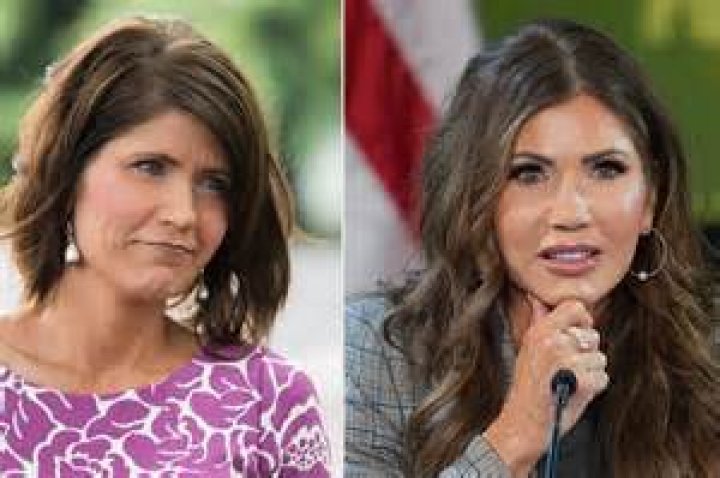 Kristi Noem's Incredible Transformation Before And After Plastic Surgery