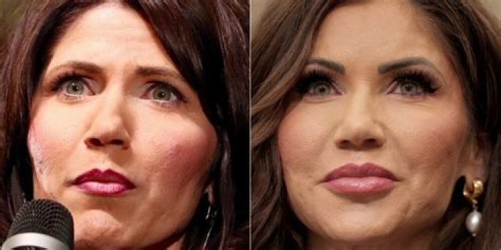 Kristie Noem's Plastic Surgery: Before And After