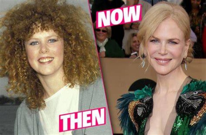 Nicole Kidman Addressed Plastic Surgery and Botox Rumors After Dramatic