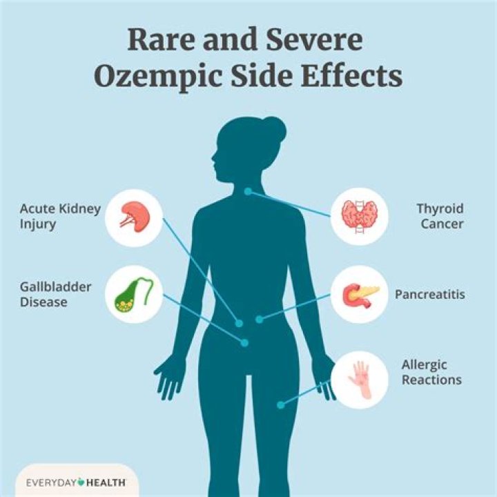 Ozempic side effects and how to avoid them SingleCare
