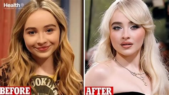 Sabrina Carpenter Plastic Surgery Before And After Photos