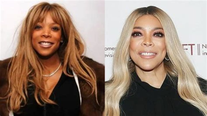 The Complete Guide To Wendy Williams' Nose Job: Before And After