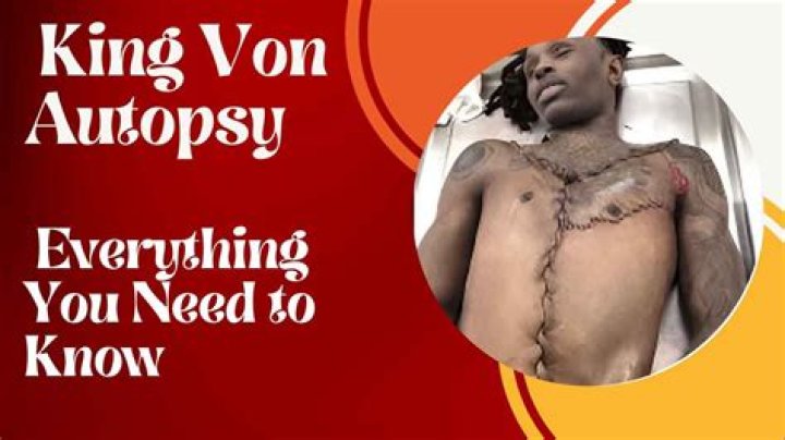 Uncovering The Tragic Truth: King Von's Autopsy Findings