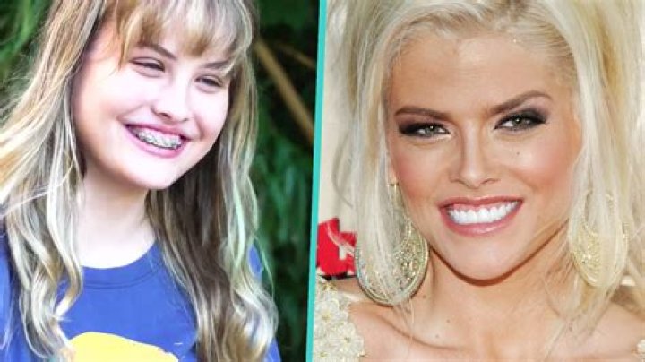 Unlocking Anna Nicole Smith's Daughter's Eye Surgery Breakthroughs