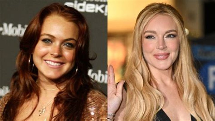 Unveiling The Truth About "Lindsey Lohan Botox": Discoveries And Insights